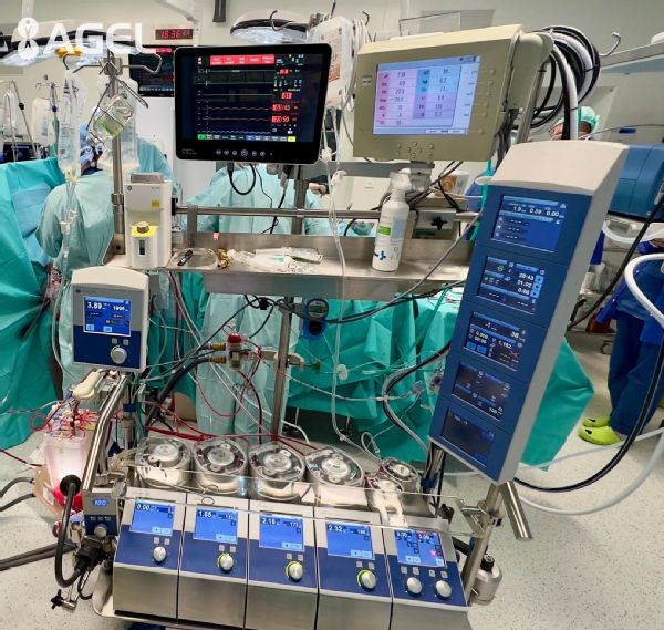 prístroj na mimotelový obeh